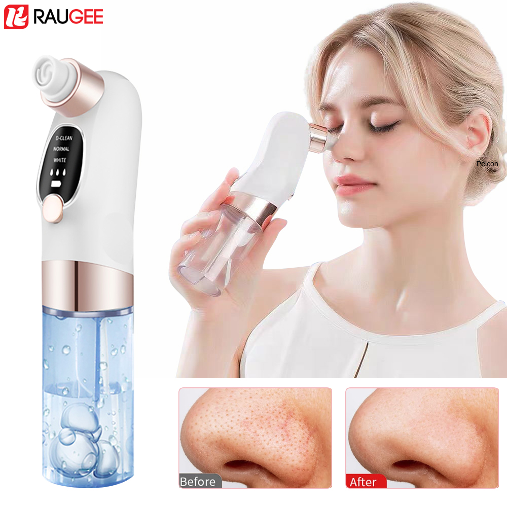 Blackhead Remover Electric Bla - Air Bubble Remover avis et prix
