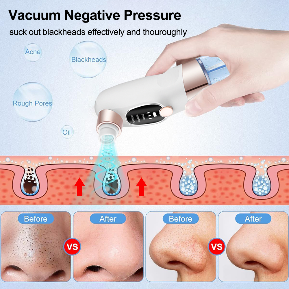 Blackhead Remover Electric Bla - Air Bubble Remover avis et prix